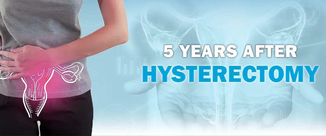 5 Years After Hysterectomy