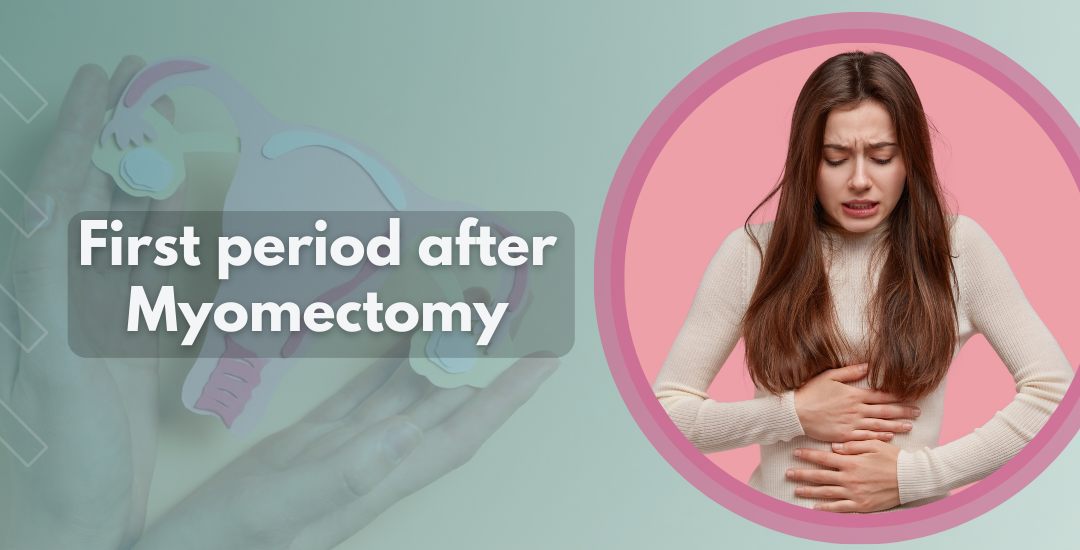 First period after Myomectomy