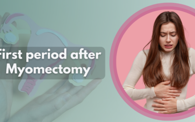 First Period After Myomectomy – Overview